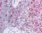 Poly(ADP-Ribose) Polymerase 1 antibody, 48-575, ProSci, Immunohistochemistry paraffin image 