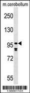 Phosphodiesterase 4A antibody, 59-005, ProSci, Western Blot image 