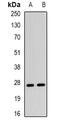 Cysteine Rich Secretory Protein 2 antibody, abx225123, Abbexa, Western Blot image 