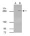 Tet Methylcytosine Dioxygenase 2 antibody, GTX629880, GeneTex, Immunoprecipitation image 