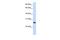 Tetratricopeptide Repeat Domain 33 antibody, GTX45366, GeneTex, Western Blot image 