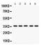 Tropomyosin 1 antibody, MA1096, Boster Biological Technology, Western Blot image 