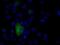 Natriuretic Peptide Receptor 3 antibody, NBP2-02401, Novus Biologicals, Immunofluorescence image 