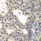 Centromere Protein C antibody, LS-C334793, Lifespan Biosciences, Immunohistochemistry paraffin image 