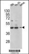 Hydroxysteroid 17-Beta Dehydrogenase 7 antibody, 62-447, ProSci, Western Blot image 