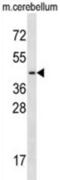 Transcription factor 7-like 2 antibody, abx026796, Abbexa, Western Blot image 