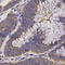 Epoxide Hydrolase 2 antibody, 15-424, ProSci, Immunohistochemistry frozen image 