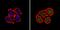 O-6-Methylguanine-DNA Methyltransferase antibody, MA5-13506, Invitrogen Antibodies, Immunofluorescence image 