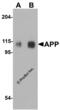 Amyloid Beta Precursor Protein antibody, 2136, ProSci Inc, Western Blot image 