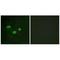 DNA (cytosine-5)-methyltransferase 3B antibody, A00319, Boster Biological Technology, Immunohistochemistry paraffin image 