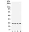 NME/NM23 Nucleoside Diphosphate Kinase 1 antibody, R31976, NSJ Bioreagents, Western Blot image 