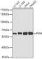 Pyruvate Kinase M1/2 antibody, 13-197, ProSci, Western Blot image 