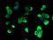V-type proton ATPase 116 kDa subunit a isoform 2 antibody, A68222-100, Epigentek, Immunofluorescence image 