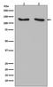 Ring Finger Protein 20 antibody, M03457-1, Boster Biological Technology, Western Blot image 