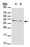 Protein Phosphatase 1 Catalytic Subunit Alpha antibody, PA5-28218, Invitrogen Antibodies, Western Blot image 