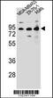CTTNBP2 N-Terminal Like antibody, 56-606, ProSci, Western Blot image 