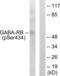 Gamma-Aminobutyric Acid Type A Receptor Beta1 Subunit antibody, LS-C198990, Lifespan Biosciences, Western Blot image 