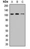 Cell Proliferation Regulating Inhibitor Of Protein Phosphatase 2A antibody, LS-C668605, Lifespan Biosciences, Western Blot image 