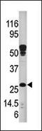 ABAD antibody, MBS9213364, MyBioSource, Western Blot image 