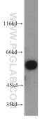 Protein Phosphatase 3 Catalytic Subunit Alpha antibody, 55147-1-AP, Proteintech Group, Western Blot image 