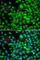 SET Domain Containing 5 antibody, A7304, ABclonal Technology, Immunohistochemistry paraffin image 
