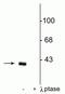 Protein Phosphatase 1 Regulatory Inhibitor Subunit 1B antibody, P03424-2, Boster Biological Technology, Western Blot image 