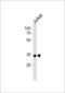 Small Nuclear RNA Activating Complex Polypeptide 2 antibody, 58-479, ProSci, Western Blot image 