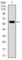 Matrix Metallopeptidase 3 antibody, abx011406, Abbexa, Western Blot image 