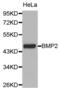 Bone Morphogenetic Protein 2 antibody, abx000616, Abbexa, Western Blot image 