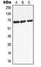 Adrenoceptor Beta 2 antibody, MBS8205112, MyBioSource, Western Blot image 
