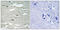 Integrin Linked Kinase antibody, 79-847, ProSci, Immunohistochemistry frozen image 
