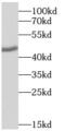 ST3 Beta-Galactoside Alpha-2,3-Sialyltransferase 3 antibody, FNab08264, FineTest, Western Blot image 