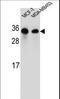 Secretion Associated Ras Related GTPase 1B antibody, LS-C162867, Lifespan Biosciences, Western Blot image 