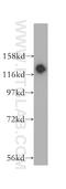 Nucleolar And Coiled-Body Phosphoprotein 1 antibody, 11815-1-AP, Proteintech Group, Western Blot image 