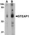 STEAP Family Member 1 antibody, orb74872, Biorbyt, Western Blot image 