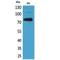 Bruton Tyrosine Kinase antibody, LS-C387104, Lifespan Biosciences, Western Blot image 