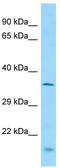 Multiple C2 And Transmembrane Domain Containing 1 antibody, TA335298, Origene, Western Blot image 