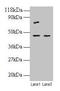Eukaryotic Translation Initiation Factor 4A2 antibody, LS-B13794, Lifespan Biosciences, Western Blot image 