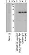 Insulin Receptor antibody, GTX25680, GeneTex, Western Blot image 