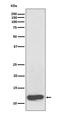 Serum Amyloid A1 antibody, M01362, Boster Biological Technology, Western Blot image 