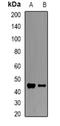Hereditary hemochromatosis protein antibody, orb340750, Biorbyt, Western Blot image 