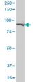 Pseudopodium Enriched Atypical Kinase 1 antibody, H00079834-M02, Novus Biologicals, Western Blot image 