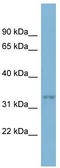 Developing Brain Homeobox 2 antibody, TA342391, Origene, Western Blot image 