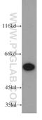 Pyruvate Kinase M1/2 antibody, 15822-1-AP, Proteintech Group, Western Blot image 