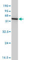 Glutathione Synthetase antibody, LS-C133890, Lifespan Biosciences, Western Blot image 