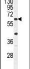 APOBEC1 Complementation Factor antibody, PA5-24164, Invitrogen Antibodies, Western Blot image 