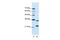 AlkB Homolog 8, TRNA Methyltransferase antibody, PA5-41937, Invitrogen Antibodies, Western Blot image 