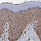 Proteasome 26S Subunit, Non-ATPase 9 antibody, PA5-59203, Invitrogen Antibodies, Immunohistochemistry frozen image 