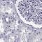 Ribonuclease A Family Member 12 (Inactive) antibody, NBP1-94162, Novus Biologicals, Immunohistochemistry paraffin image 