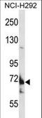 Transmembrane Channel Like 8 antibody, LS-C161947, Lifespan Biosciences, Western Blot image 